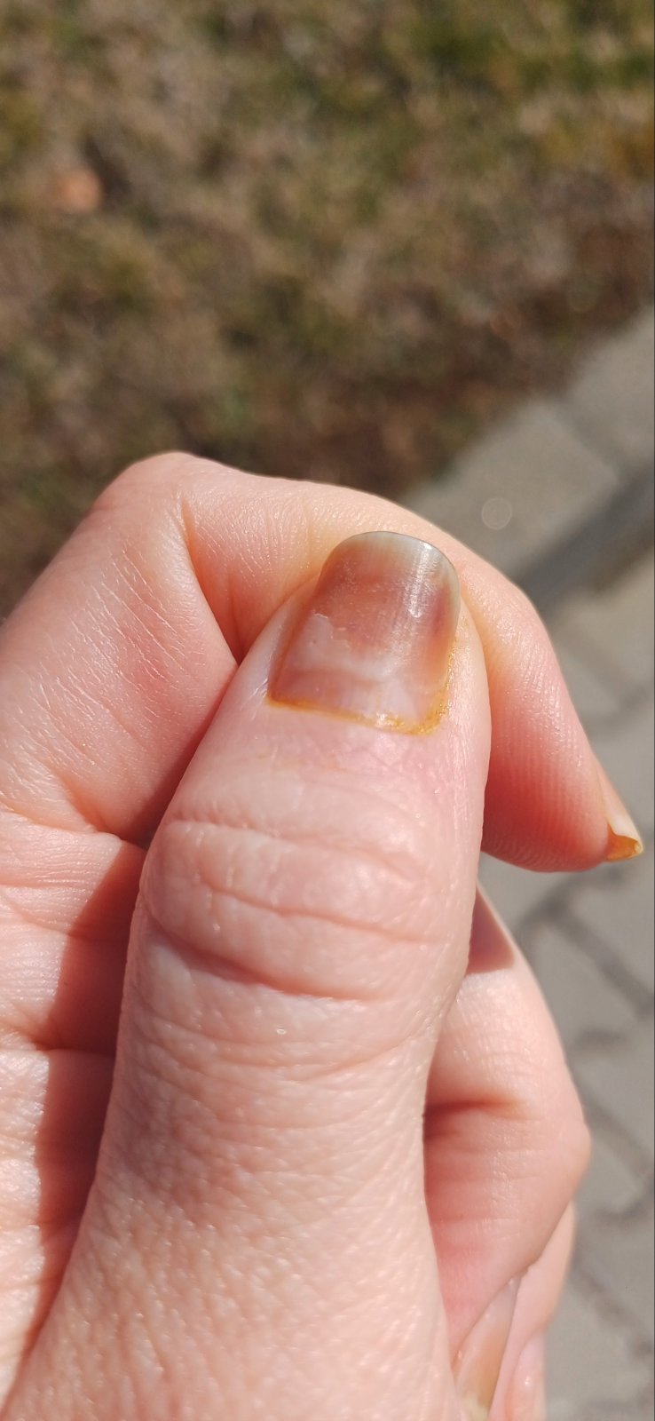 Комплект "Възстановяване" (ръце)